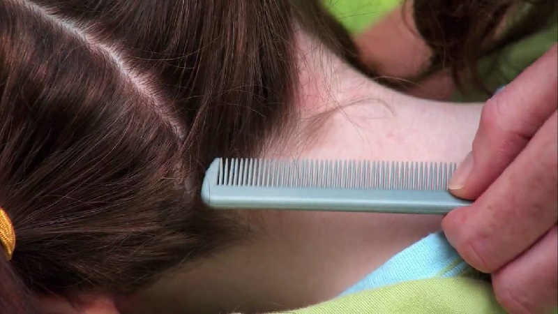 How to Check for Head Lice and Nits: A Step-by-Step Guide